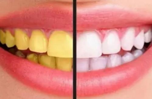 8 cách làm trắng răng tự nhiên đơn giản ngay tại nhà