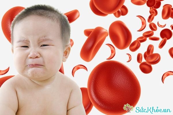 Trẻ em cũng có nguy cơ bị thiếu máu