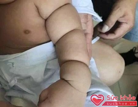Bé trai 3 tháng tuổi mập mạp thân hình mũm mĩm 
