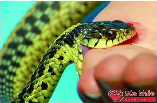 Khi nhìn vết răng cắn để lại trên da, có thể phân biệt rắn độc với rắn thường