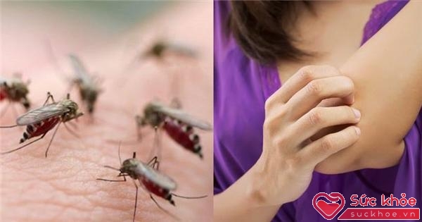 Phụ nữ mang thai có khả năng bị muỗi đốt nhiều gấp đôi những người bình thường.