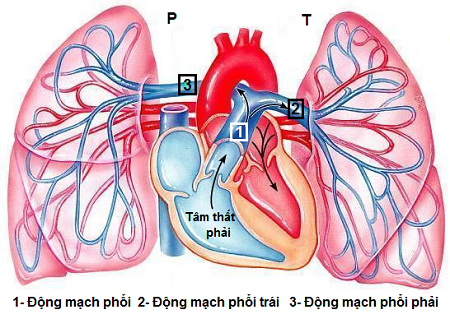 Sơ đồ hệ thống ĐMP: 1 - Động mạch phổi, 2 - động mạch phổi trái, 3 - động mạch phổi phải.