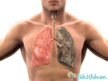 Làm sạch phổi giúp phòng các bệnh về phổi